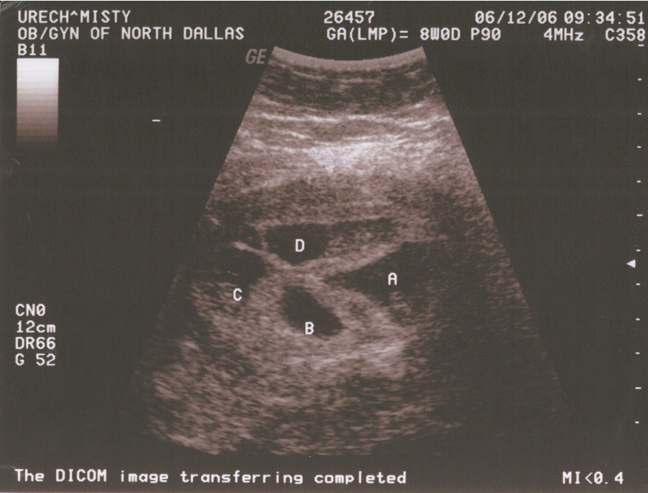 ultrasound1.JPG